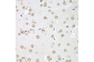 Immunohistochemistry of paraffin-embedded rat brain using PRMT5 antibody. (PRMT5 抗体)