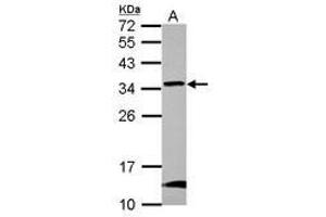Image no. 1 for anti-Glioblastoma Amplified Sequence (GBAS) (AA 77-265) antibody (ABIN1498393) (GBAS 抗体  (AA 77-265))