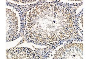 ABIN7096401 and ABIN7100465 at 1/100 staining rat testis tissue by IHC-P. (SPEF1 抗体)