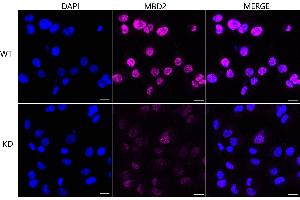 Immunocytochemical staining of HT- cells using MBD2 antibody (ABIN7799386), 1:1,000), Top panel: wild-type (WT), Bottom panal: MBD2 shRNA knockdown (KD). (Recombinant MBD2 抗体)