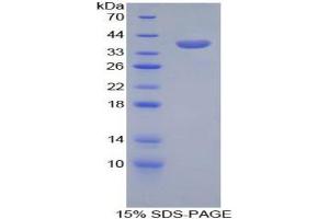 SDS-PAGE analysis of Mouse CPB1 Protein. (CPB1 蛋白)