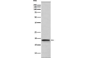 Western blot analysis of TNF beta expression in TNF beta recombinant protein.