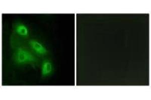 Immunofluorescence analysis of HeLa cells, using ES8L3 antibody. (EPS8-Like 3 抗体)
