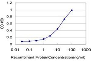 Detection limit for recombinant GST tagged CTNS is approximately 0. (CTNS 抗体  (AA 1-100))