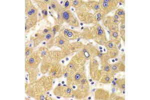 Immunohistochemistry (Paraffin-embedded Sections) (IHC (p)) image for anti-Kinesin Family Member 1B (KIF1B) (AA 1501-1770) antibody (ABIN6142861)