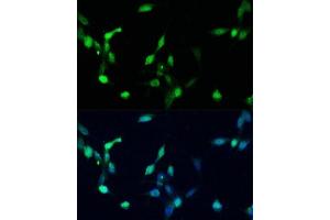 Immunofluorescence analysis of NIH/3T3 cells using p27 KIP 1 antibody (ABIN3020889, ABIN3020890, ABIN3020891 and ABIN6213779) at dilution of 1:100. (CDKN1B 抗体  (AA 1-198))