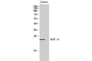 Western Blotting (WB) image for anti-A Kinase (PRKA) Anchor Protein 14 (AKAP14) (N-Term) antibody (ABIN3183219) (AKAP14 抗体  (N-Term))