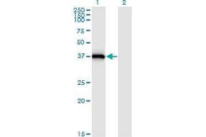 Western Blot analysis of STX16 expression in transfected 293T cell line by STX16 monoclonal antibody (M03), clone 3D12. (Syntaxin 16 抗体  (AA 1-99))