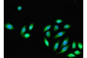 Immunofluorescent analysis of A549 cells using ABIN7145131 at dilution of 1:100 and Alexa Fluor 488-congugated AffiniPure Goat Anti-Rabbit IgG(H+L) (DNALI1 抗体  (AA 1-258))