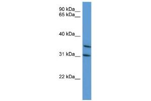 WB Suggested Anti-MAPKAPK3 Antibody Titration: 0. (MAPKAP Kinase 3 抗体  (C-Term))