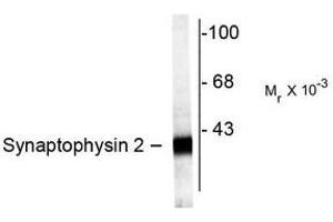 Image no. 1 for anti-Synaptoporin (SYNPR) (C-Term) antibody (ABIN372722) (Synaptoporin 抗体  (C-Term))