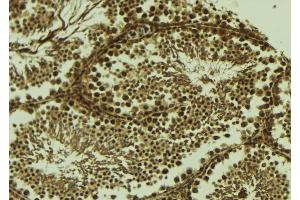 ABIN6273707 at 1/100 staining Mouse testis tissue by IHC-P. (SYCP1 抗体  (C-Term))