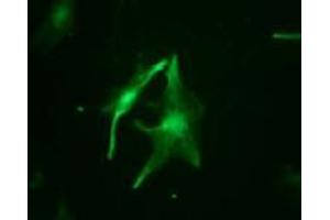 Immunofluorescence (IF) image for anti-Vimentin (VIM) (pSer6) antibody (ABIN1449149)