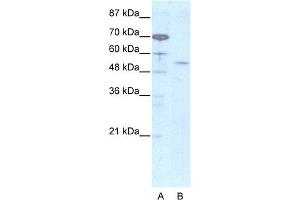 WB Suggested Anti-EVX2 Antibody Titration:  2. (EVX2 抗体  (N-Term))
