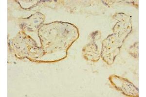 Immunohistochemistry of paraffin-embedded human placenta tissue using ABIN7156525 at dilution of 1:100 (ITIH5 抗体  (AA 35-161))
