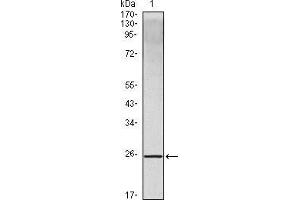 Western blot analysis using IL10 mouse mAb against IL10 recombinant protein. (IL-10 抗体)