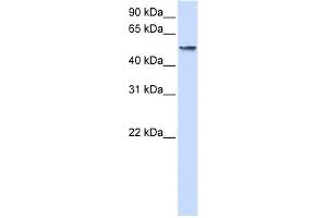 USP22 antibody used at 1 ug/ml to detect target protein. (USP22 抗体  (Middle Region))