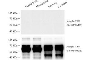 Western blot analysis of phospho-TAU (S202/T205) (ABIN7075838) at dilution of 1: 1000 The figure above was treated with phospho-blocking pepide, the figure below was treated with non-phospho- blocking pepide. (tau 抗体  (pSer202, pThr205))