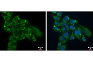 ICC/IF Image TSFM antibody detects TSFM protein at mitochondria by immunofluorescent analysis. (TSFM 抗体)