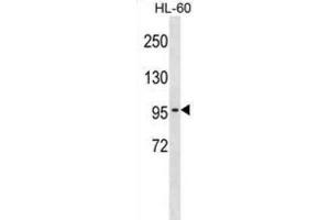 Western Blotting (WB) image for anti-Chloride Channel 2 (CLCN2) antibody (ABIN2998951) (CLCN2 抗体)