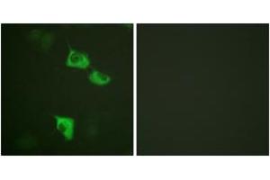 Immunofluorescence analysis of HuvEc cells, using eEF2 (Ab-56) Antibody. (EEF2 抗体  (AA 31-80))