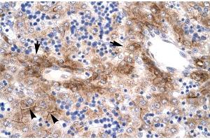 Immunohistochemistry (IHC) image for anti-Nuclear Receptor Subfamily 5, Group A, Member 1 (NR5A1) (Middle Region) antibody (ABIN2777447)