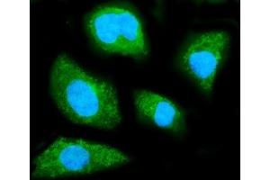 IF analysis of GNB1 using anti-GNB1 antibody (ABIN7603148).