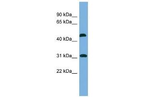 CTDSP2 antibody used at 1 ug/ml to detect target protein. (CTDSP2 抗体)