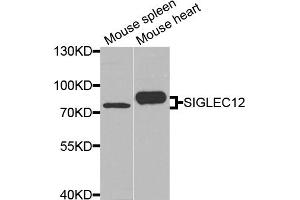 Western blot analysis of extracts of various cell lines, using SIGLEC12 antibody. (SIGLEC12 抗体)