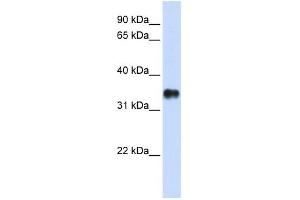 KCTD7 antibody used at 1 ug/ml to detect target protein.