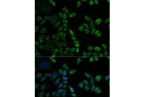 Immunofluorescence analysis of U2OS cells using MSLN Polyclonal Antibody (Mesothelin 抗体)
