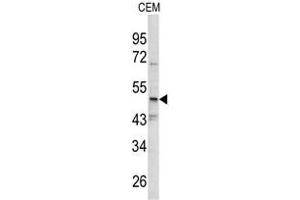 Western blot analysis of SMYD3 antibody (N-term) in CEM cell line lysates (35ug/lane). (SMYD3 抗体  (N-Term))