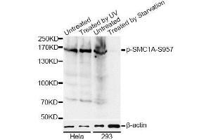 Western blot analysis of extracts of various cell lines, using Phospho-SMC1A-S957 antibody.