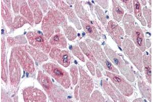 Human Heart (formalin-fixed, paraffin-embedded) stained with PARD6A antibody ABIN337017 at 5 ug/ml followed by biotinylated anti-goat IgG secondary antibody ABIN481715, alkaline phosphatase-streptavidin and chromogen. (PARD6A 抗体  (AA 334-346))