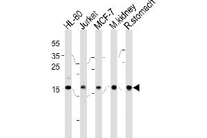 NME2 Antibody (F40) (ABIN392656 and ABIN2842157) western blot analysis in HL-60,Jurkat,MCF-7 cell line,mouse kidney and rat stomach tissue lysates (35 μg/lane). (NME2 抗体  (N-Term))