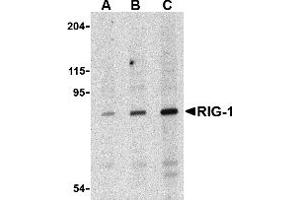 Western Blotting (WB) image for anti-DEAD (Asp-Glu-Ala-Asp) Box Polypeptide 58 (DDX58) antibody (ABIN1031791) (DDX58 抗体)