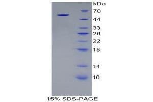 SDS-PAGE (SDS) image for Alanine Aminotransferase (ALT) (AA 1-496) protein (His tag) (ABIN1078750) (ALT Protein (AA 1-496) (His tag))