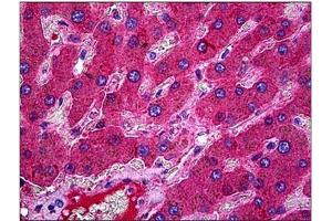 Human Liver: Formalin-Fixed, Paraffin-Embedded (FFPE). (C3 抗体)