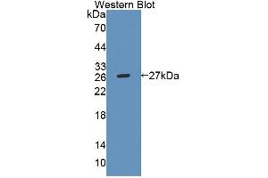 Western Blotting (WB) image for anti-ATP-Binding Cassette, Sub-Family A (ABC1), Member 8 (ABCA8) (AA 1305-1516) antibody (ABIN5013174)