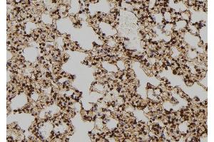 ABIN6277586 at 1/100 staining Rat lung tissue by IHC-P. (TPT1 抗体  (Internal Region))