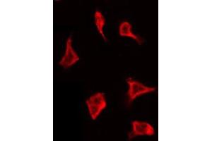 ABIN6267692 staining 293 by IF/ICC. (WNK1 抗体  (pThr60))