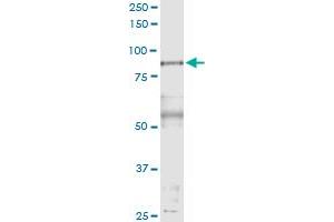Immunoprecipitation of PFKP transfected lysate using anti-PFKP MaxPab rabbit polyclonal antibody and Protein A Magnetic Bead , and immunoblotted with PFKP purified MaxPab mouse polyclonal antibody (B01P) . (PFKP 抗体  (AA 1-784))