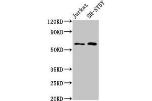 Western Blot Positive WB detected in: Jurkat whole cell lysate, SH-SY5Y whole cell lysate All lanes: BORA antibody at 4. (BORA 抗体  (AA 178-312))