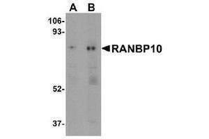 Western blot analysis of RANBP10 (arrow) in human skeletal muscle tissue lysate with RANBP10 Antibody at (A) 1 and (B) 2 μg/ml. (RANBP10 抗体  (Center))