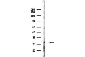 Western blot analysis of lysates from Mouse lung, using HLA-DQ Antibody at 1/1000 dilution.