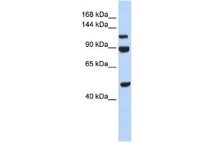 WB Suggested Anti-NARG1L Antibody Titration:  0. (NARG1L 抗体  (Middle Region))