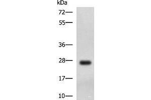 Western blot analysis of MCF7 cell lysate using DHRS2 Polyclonal Antibody at dilution of 1:750 (DHRS2 抗体)