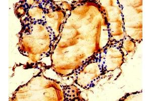 IHC image of ABIN7158752 diluted at 1:200 and staining in paraffin-embedded human thyroid tissue performed on a Leica BondTM system. (LPCAT2 抗体  (AA 442-544))
