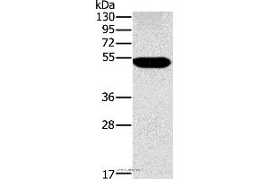 Western blot analysis of Human placenta tissue, using FUCA1 Polyclonal Antibody at dilution of 1:500