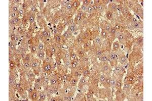 Immunohistochemistry of paraffin-embedded human liver tissue using ABIN7163820 at dilution of 1:100 (PKD1L1 抗体  (AA 921-1164))